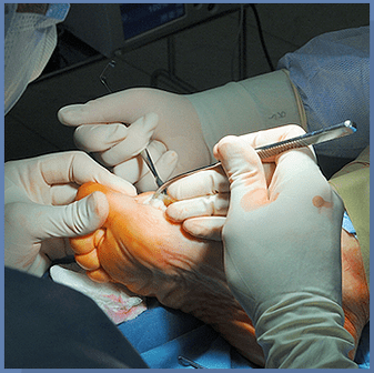 surgery