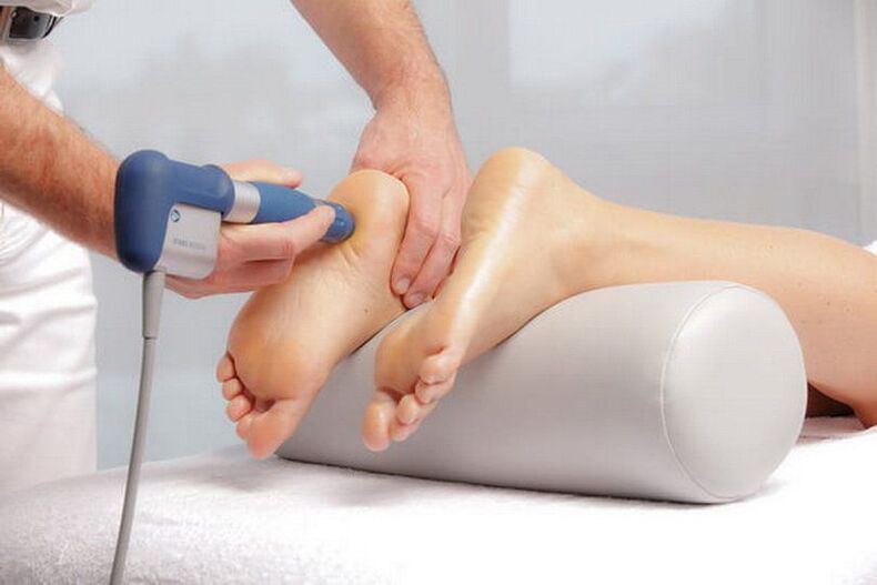 Carrying out shock wave therapy