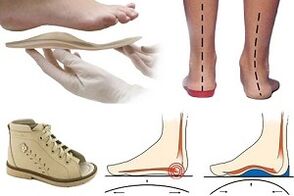 orthopedic shoes for hallux valgus in children