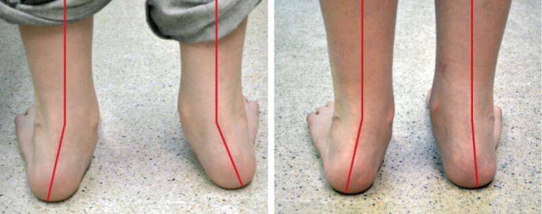 Valguse leg