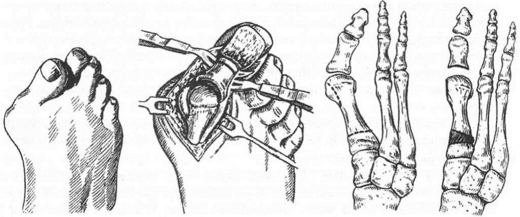 Types of treatment