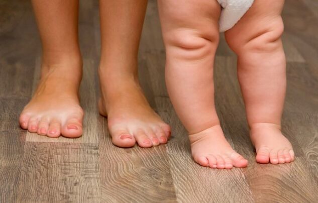 Valgus foot deformation in children