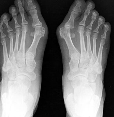 X -aj feet