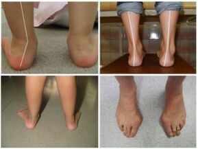 Types of Curvara